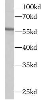 OXCT1 Rabbit Polyclonal Antibody