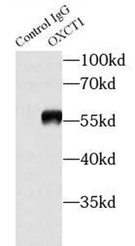 OXCT1 Rabbit Polyclonal Antibody