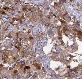 OXCT1 Rabbit Polyclonal Antibody