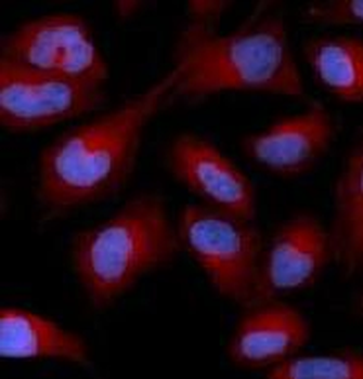 RAPGEF3 Rabbit Polyclonal Antibody