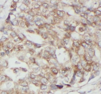 JAK1 Antibody