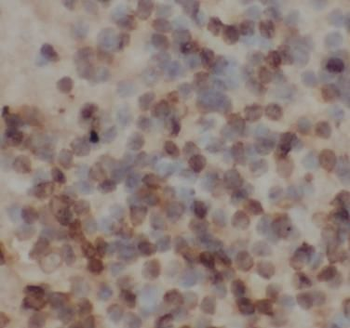 CDR2 Rabbit Polyclonal Antibody