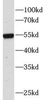 heavy chain Of IgG4 Mouse Monoclonal Antibody