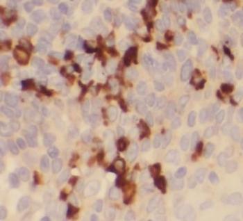 heavy chain Of IgG4 Mouse Monoclonal Antibody