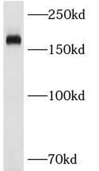 CD206 Antibody