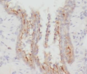 CD206 Antibody