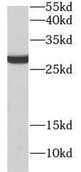 CD151 Mouse Monoclonal Antibody