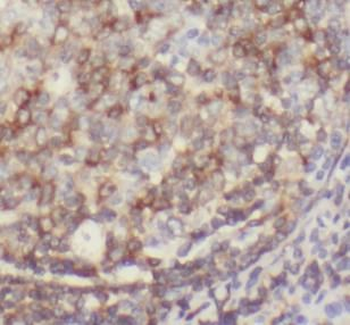 CD151 Mouse Monoclonal Antibody
