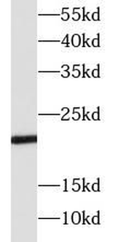 SOCS1 Antibody
