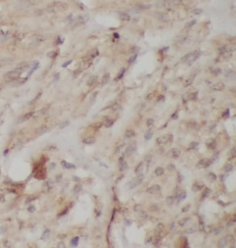VEGFA Mouse Monoclonal Antibody