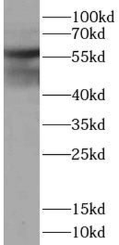 Pan Keratin Antibody