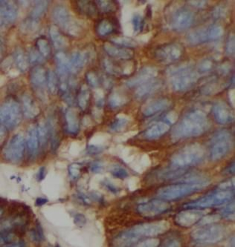 Pan Keratin Antibody