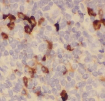 CTLA4 Antibody