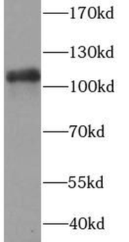 PARP1 Mouse Monoclonal Antibody