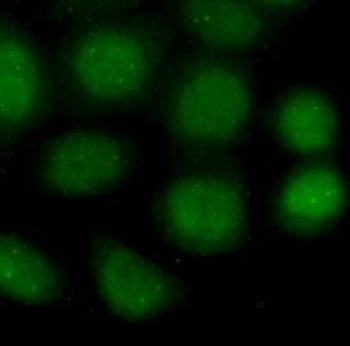 PARP1 Mouse Monoclonal Antibody