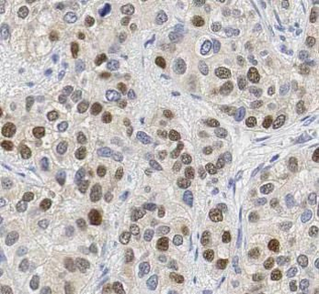 PARP1 Mouse Monoclonal Antibody