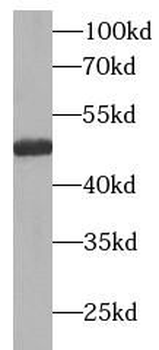 AKT1S1 Rabbit Polyclonal Antibody