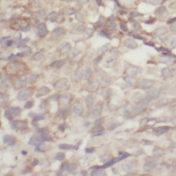 AKT1S1 Rabbit Polyclonal Antibody