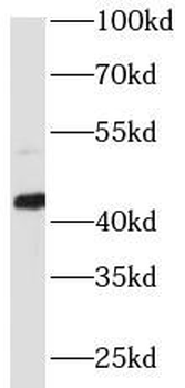 Phospho-CREB1(S133) Antibody