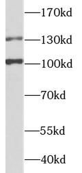 ZEB2 Rabbit Polyclonal Antibody