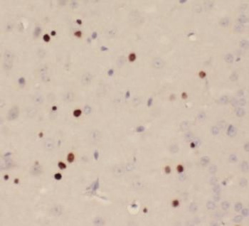 ZEB2 Rabbit Polyclonal Antibody