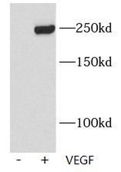 Phospho VEGF Receptor 2 (Y1175) Rabbit Polyclonal Antibody