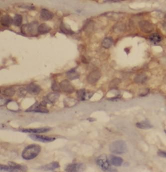 Phospho VEGF Receptor 2 (Y1175) Rabbit Polyclonal Antibody