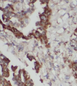PTGS2 Mouse Monoclonal Antibody