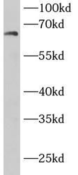 DBH Rabbit Polyclonal Antibody