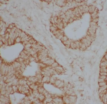 DBH Rabbit Polyclonal Antibody