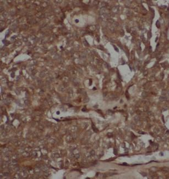STAT1 Antibody