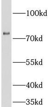 MX1 Rabbit Polyclonal Antibody