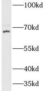CLPX Rabbit Polyclonal Antibody