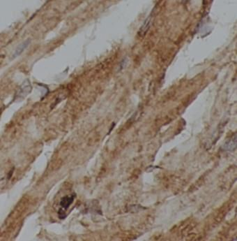 CLPX Rabbit Polyclonal Antibody