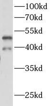 RHD Antibody