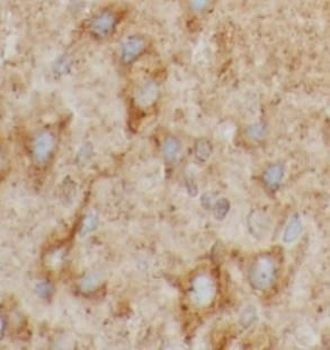 PRKCG Rabbit Polyclonal Antibody