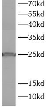 LMO1 Rabbit Polyclonal Antibody