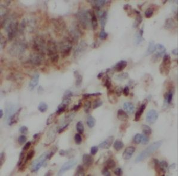 LMO1 Rabbit Polyclonal Antibody