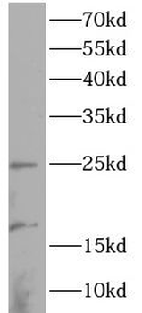 LMO2 Rabbit Polyclonal Antibody