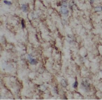 LMO2 Rabbit Polyclonal Antibody