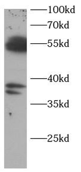 CASP8 Rabbit Polyclonal Antibody