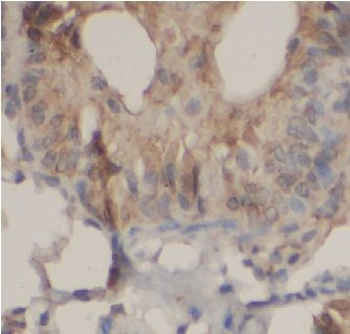 CASP8 Rabbit Polyclonal Antibody