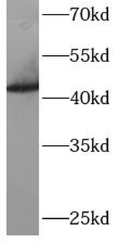 ARFGAP1 Rabbit Polyclonal Antibody