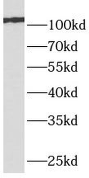 GRM4 Rabbit Polyclonal Antibody