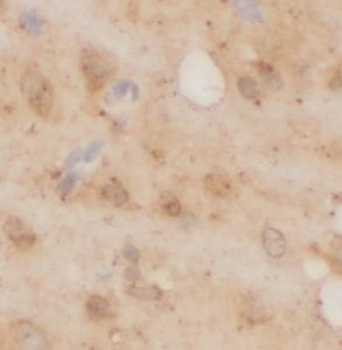 GRM4 Rabbit Polyclonal Antibody