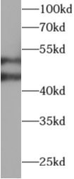 WARS1 Rabbit Polyclonal Antibody