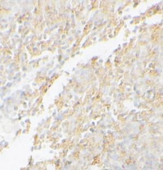 WARS1 Rabbit Polyclonal Antibody