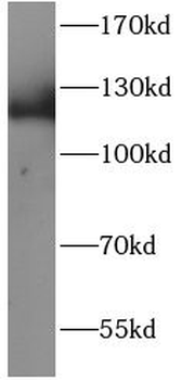 EML4 Rabbit Polyclonal Antibody