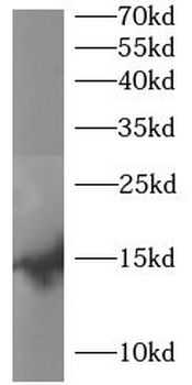 SNCB Rabbit Polyclonal Antibody