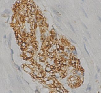 SNCB Rabbit Polyclonal Antibody